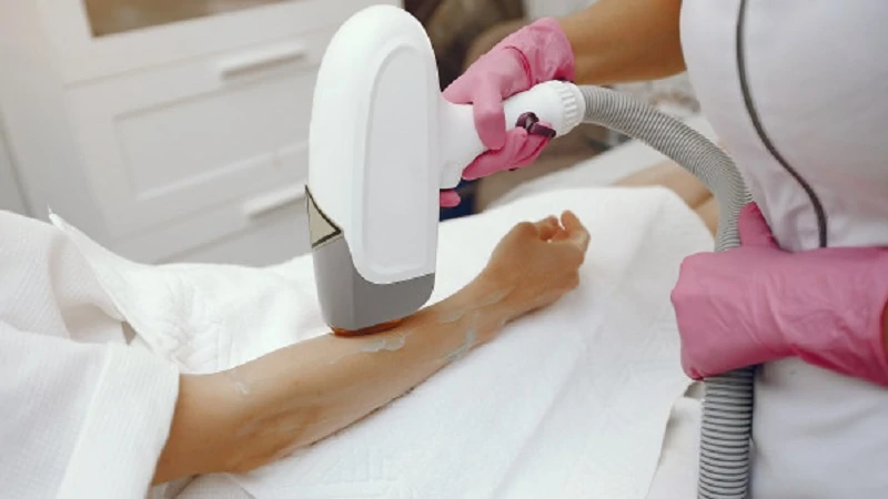 Laser Hair Removal image